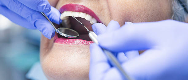 Best Dentist for Tooth Abscess  in Lake Lakengren, OH